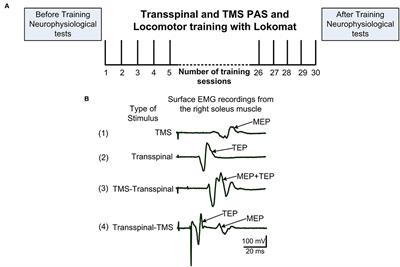 Neurophysiological Changes After Paired Brain and Spinal Cord Stimulation Coupled With Locomotor Training in Human Spinal Cord Injury